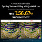 Dr Melaxin - Eyephalt Eye Cream for Dark Circles and Puffiness, Under-Eye Cream for Bags with Bio-Spicule Yazdan Store